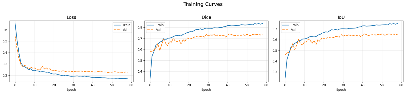 Segmentation training curves